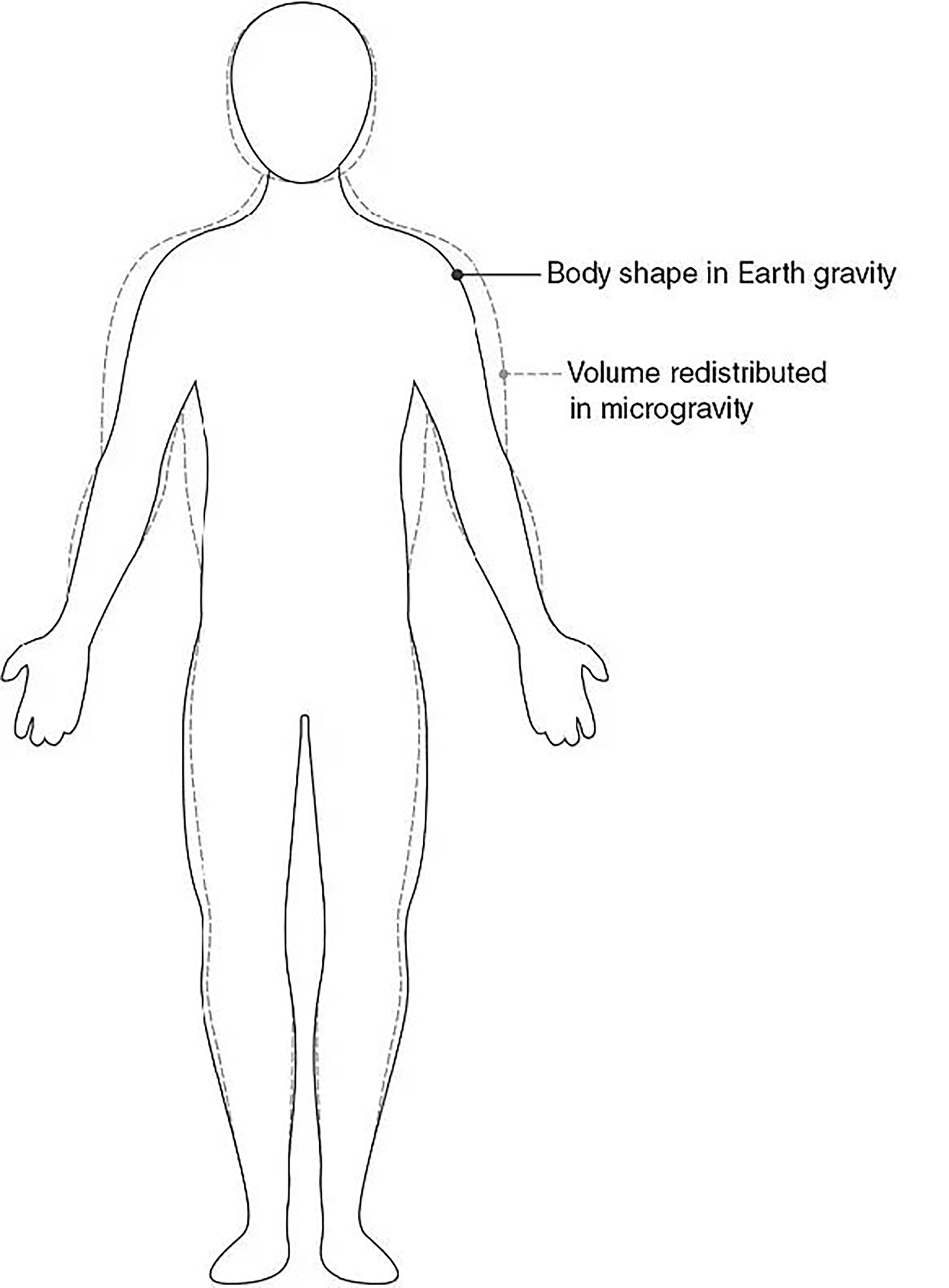 Body volume redistribution diagram, 1G versus microgravity silhouette outlines